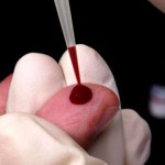 اختبار بسيط للدم للتنبؤ بالزهايمر