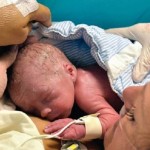 امرأة سويدية تضع أول مولود من رحم مزروع