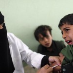 نصف أطفال اليمن يعانون من سوء التغذية