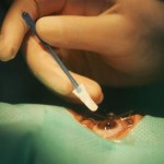 أوروبا.. أول علاج بالخلايا الجذعية للعين