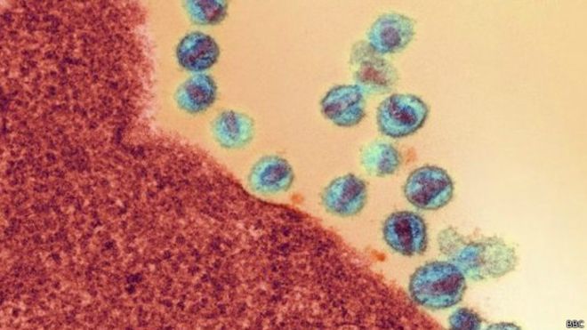 عقار لعلاج السرطان “يُخرج” فيروس الإيدز الكامن للمساعدة في قتله