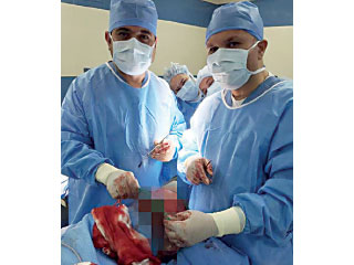 ترميم جمجمة في مستشفى مدينة زايد