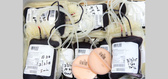 «الصحة» تصنع مشتقات بلازما الدم لوقف استيرادها من الخارج