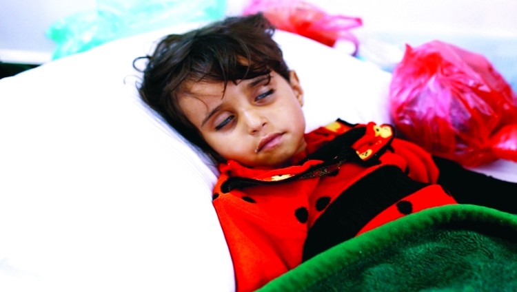 الأمم المتحدة: كوليرا اليمن الأسوأ على الإطلاق والمجاعة قادمة