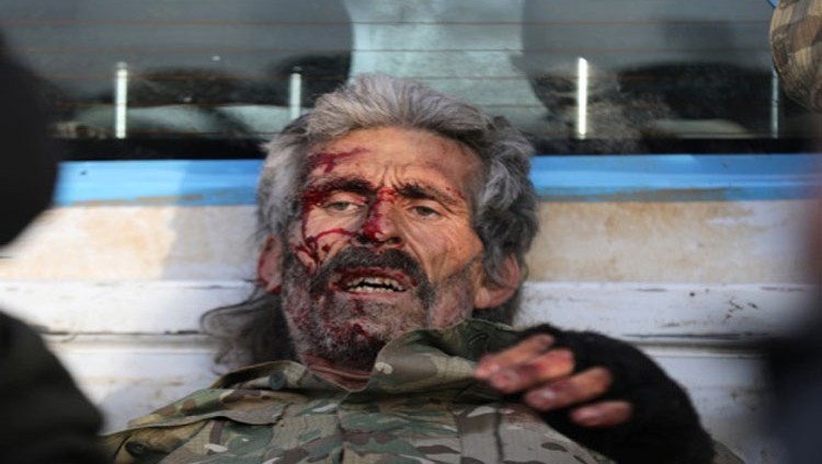 نزيف الغوطة يتواصل والضحايا مدنيون
