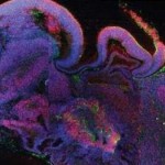 علماء ينجحون في تحفيز “مخ” على النمو