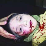 صورة الطفلة السورية الجريحة تفوز بجائزة اليونيسيف
