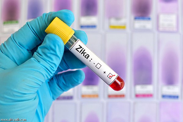 تسجيل أول حالة وفاة مرتبطة بفيروس زيكا في أمريكا